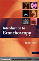 Introduction to bronchoscopy