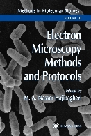 Electron microscopy methods and protocols