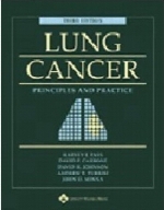 Lung cancer : principles and practice