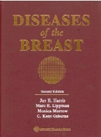 Diseases of the breast,2nd ed.