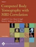 Computed body tomography with MRI correlation