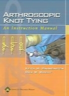 Arthroscopic knot tying : an instruction manual