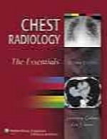 Chest radiology : the essentials