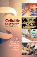 Cellulite : pathophysiology and treatment