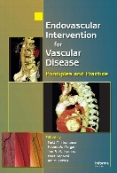 Endovascular intervention for vascular disease : principles and practice