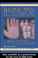 Hand Eczema, Second Edition.