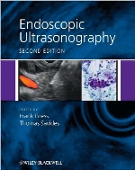 Endoscopic ultrasonography