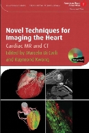 Novel techniques for imaging the heart : cardiac MR and CT