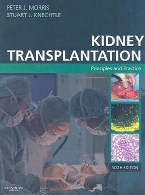 Kidney transplantation : principles and practice