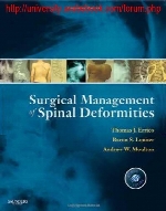 Surgical management of spinal deformities
