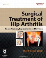 Surgical treatment of hip arthritis : reconstruction, replacement, and revision