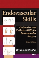 Endovascular Skills : Guidewire and Catheter Skills for Endovascular Surgery.