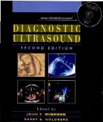 Diagnostic ultrasound