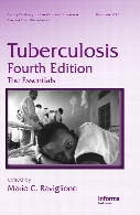 Tuberculosis : the essentials
