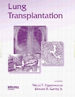 Lung transplantation