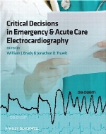 Critical Decisions in Emergency and Acute Care : Electrocardiography.