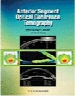 Anterior segment optical coherence tomography