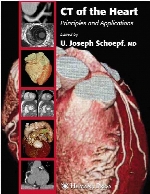 CT of the heart : principles and applications