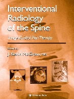 Interventional radiology of the spine : image-guided pain therapy