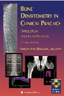 Bone densitometry in clinical practice : application and interpretation