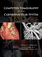 Computed tomography of the cardiovascular system