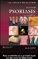 An atlas of psoriasis