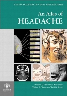 An atlas of headache