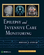 Epilepsy and intensive care monitoring : principles and practice