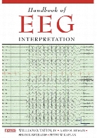 Handbook of EEG interpretation