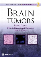 Brain Tumors : Consultant Pathology Series.