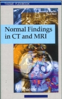Normal findings in CT and MRI