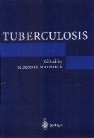 Tuberculosis