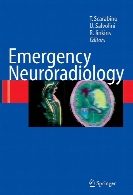 Emergency neuroradiology