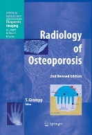 Radiology of osteoporosis,2nd rev. edView