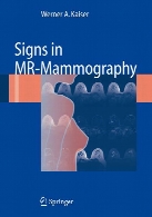 Signs in MR-mammography