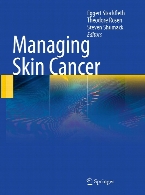 Managing skin cancer