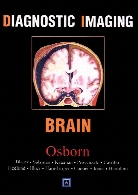 Diagnostic imaging. Brain