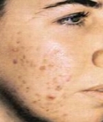 راهنمای بیماریهای شایع پوست و مو