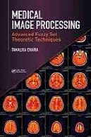 پردازش تصویر پزشکی: مجموعه فازی تکنیک های پیشرفته نظریMedical image processing : advanced fuzzy set theoretic techniques