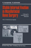 پایدار تثبیت داخلی در جراحی استخوان فک و صورت : راهنمای کارکنان اتاق عملStable Internal Fixation in Maxillofacial Bone Surgery: A Manual for Operating Room Personnel