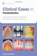 موارد بالینی در پروتزClinical Cases in Prosthodontics