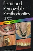 پروتز ثابت و متحرک : guida رنگFixed and removable prosthodontics : color guida