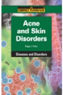 آکنه و اختلالات پوستیAcne and Skin Disorders