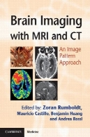 تصویربرداری از مغز با MRI و CT: رویکرد الگوی تصویرBrain Imaging with MRI and CT: An Image Pattern Approach