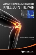 پیشرفته کمی تصویربرداری از زانو تعمیر مشترکAdvanced Quantitative Imaging of Knee Joint Repair