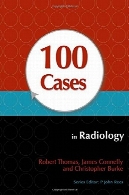 100 نفر در رادیولوژی100 Cases in Radiology