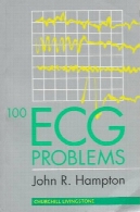مشکلات EKG 100100 EKG Problems