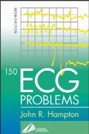 مشکلات ECG 150150 ECG Problems
