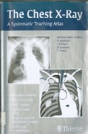 اطلس X-Ray-آموزش سیستماتیک قفسه سینه.The Chest X-Ray-The Systematic Teaching Atlas.
