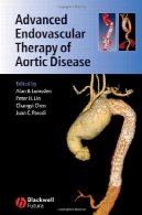 پیشرفته اندوواسکولار درمان بیماری های آئورتAdvanced Endovascular Therapy of Aortic Disease